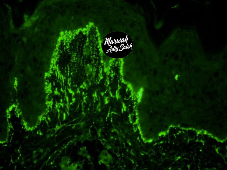 DIF Case 5 Image