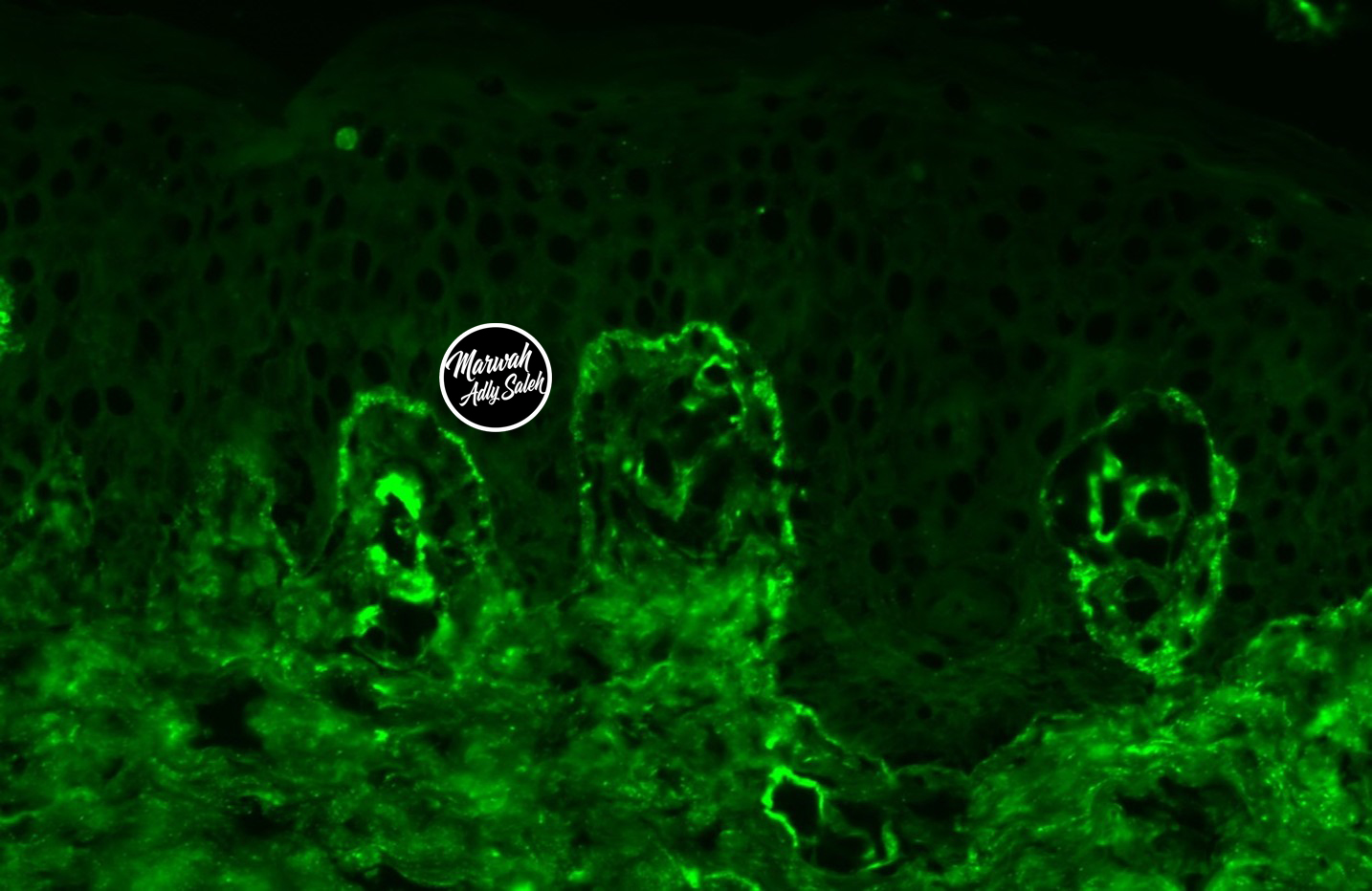 DIF Case 7 Image