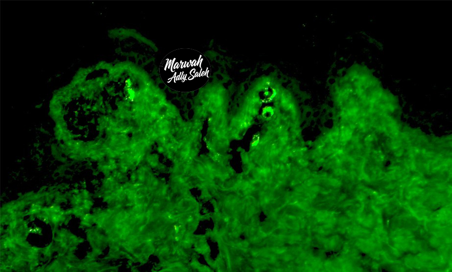 DIF Case 9 Image